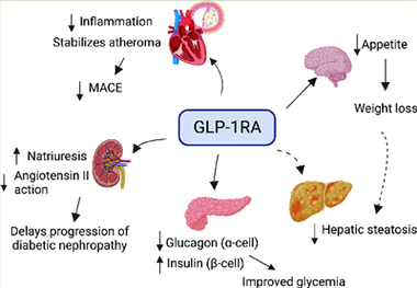 GLP-1-receptoragonister: ett nytt hopp för behandling av typ 2-diabetes